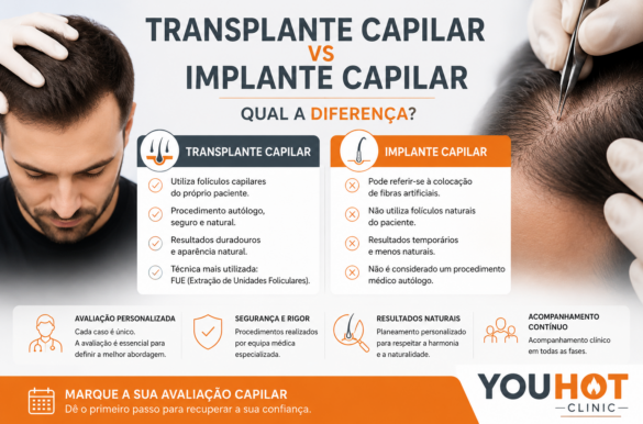 Transplante Capilar vs Implante Capilar: Qual a Diferença?